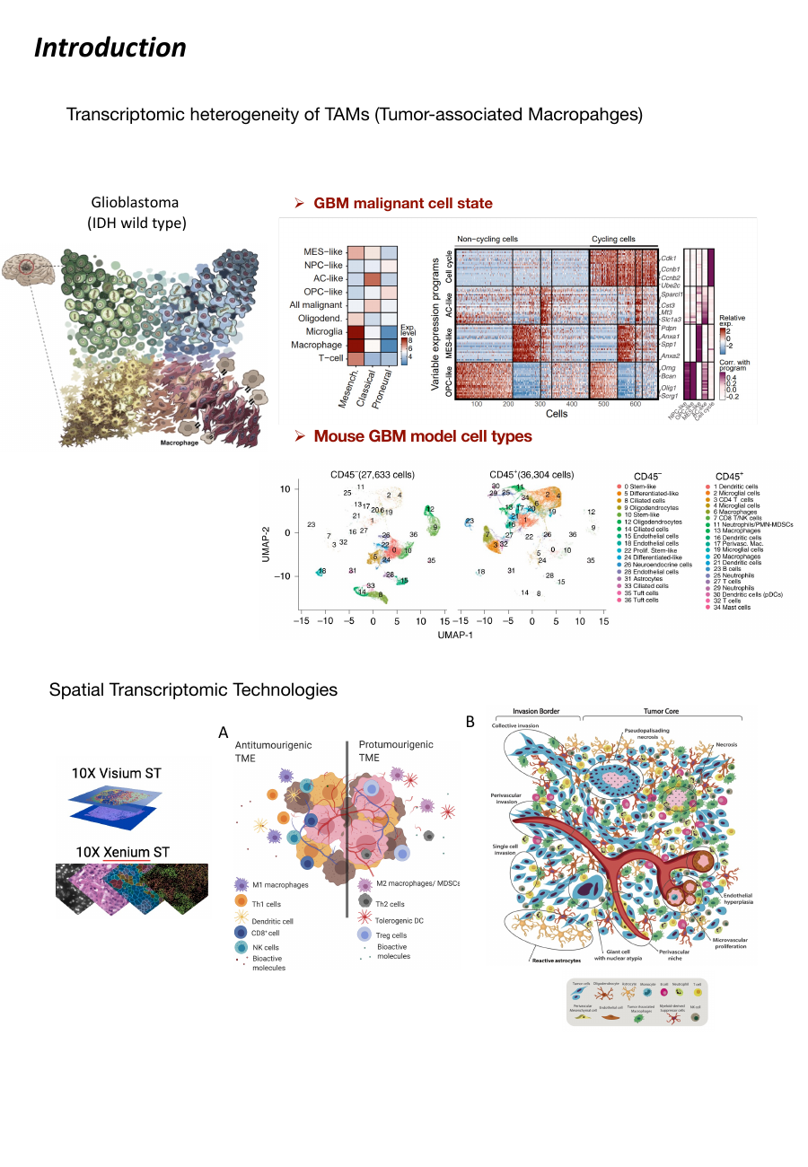 Spatial transcriptomics of glioblastoma TAMs